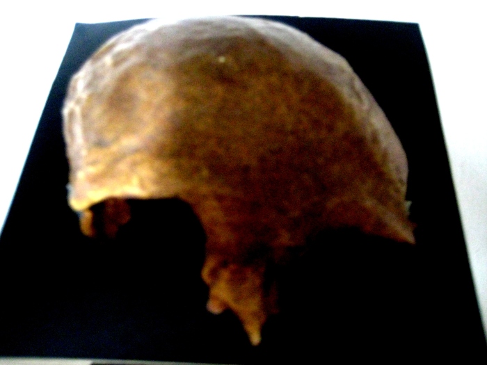 Skull cap of the Tabon Man